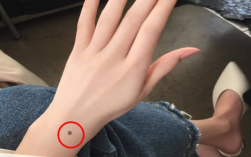 Tìm hiểu về ý nghĩa các vị trí nốt ruồi ở cánh tay thường thấy