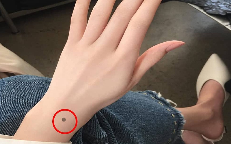 Vị trí nốt ruồi ở cổ tay thể hiện ý nghĩa gì theo nhân tướng học?